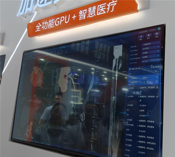 摩尔线程WAIC亮出硬核科技：国产全功能GPU加速AI与千行百业(图18)